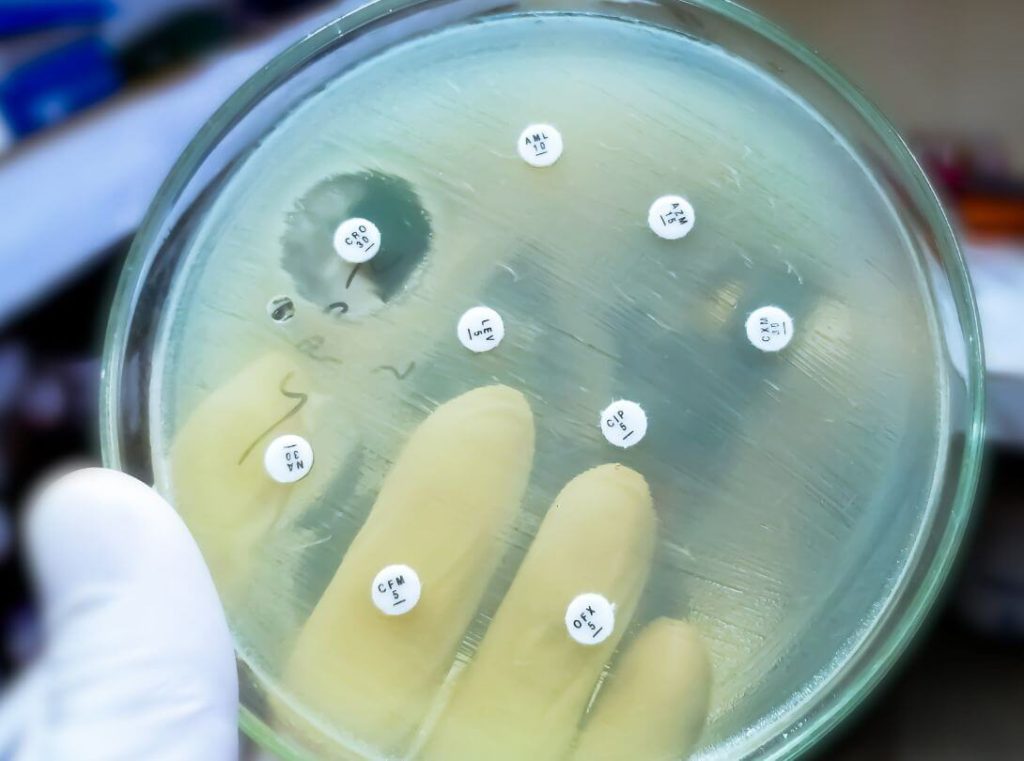 Mecanismos de resistencia a antibióticos en bacterias