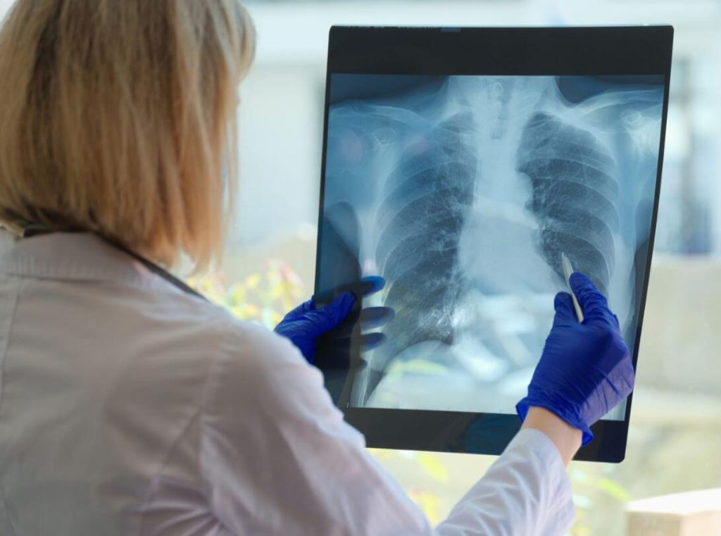 Micobacterias ambientales y sus efectos en la salud